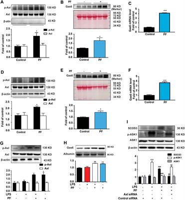 Paeoniflorin Inhibits ASK1-TF Axis by Up-Regulating SOCS3 to Alleviate Radiation Enteritis